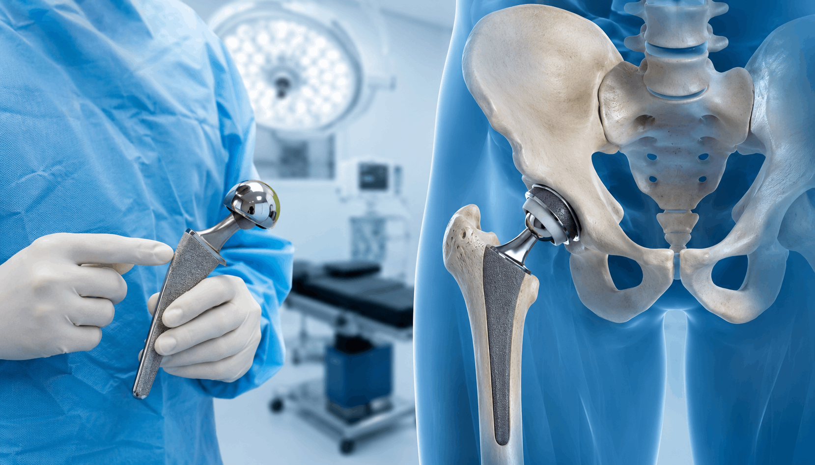 Total Hip Replacement Surgery: Procedure, Benefits and Recovery